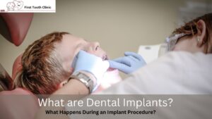 Dental Implants- First Tooth Clinic