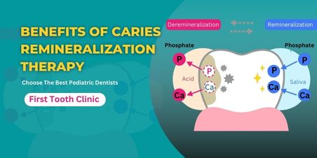 BENEFITS OF CARIES REMINERALIZATION THERAPY- First Tooth Clinic