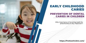 Early Childhood Caries: Prevention of Dental Caries in Children- First Tooth Clinic