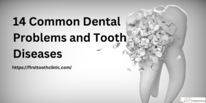 14 Common Dental Problems and Tooth Diseases- Firsttoothclinic
