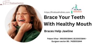 Brace Your Teeth With Healthy Mouth -Braces Help Jawline-best dental clinic in Gurgaon- Firsttoothclinic