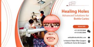 Healing Holes Advanced Solutions for Bottle Caries- Firsttoothclinic