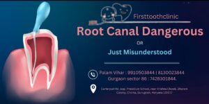 Root Canal Dangerous or misunderstood- Root canal Treatment- Firsttoothclinic