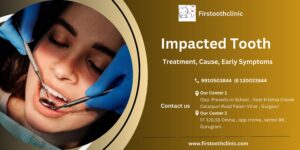 Impacted Tooth- Treatment-Cause-Early Symptoms-Best Dental Clinic in Gurgaon- Firsttoothclinic