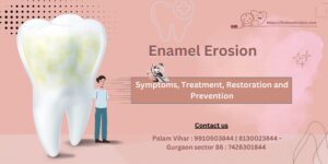 Enamel Erosion-Symptoms-Treatment-Restoration-and-Prevention-Firsttoothclinic